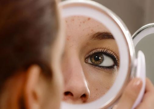 بازیابی سلامت پوست و رفع آکنه با روتین پیشنهادی یک متخصص بازیابی سلامت پوست و رفع آکنه با روتین پیشنهادی یک متخصص