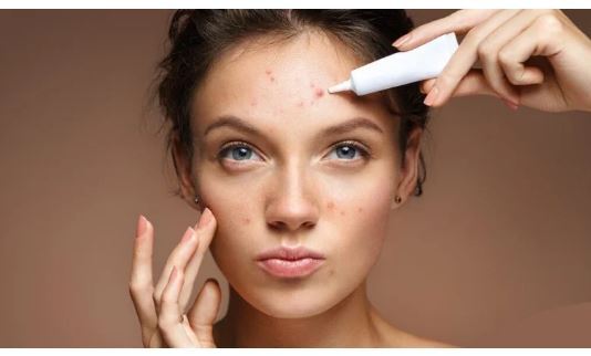 بازیابی سلامت پوست و رفع آکنه با روتین پیشنهادی یک متخصص بازیابی سلامت پوست و رفع آکنه با روتین پیشنهادی یک متخصص