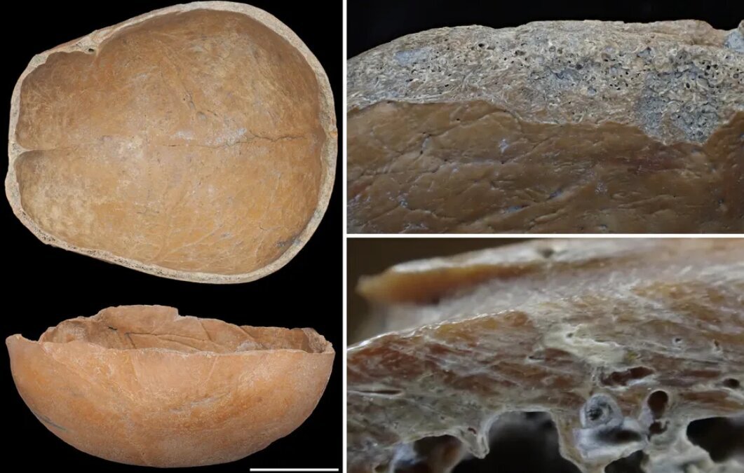 استخوان‌های انسانی کشف شده در چین که به عنوان ظرف از آنها استفاده می‌شد