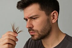 چگونه میتوان از موخوره دوری کرد؟