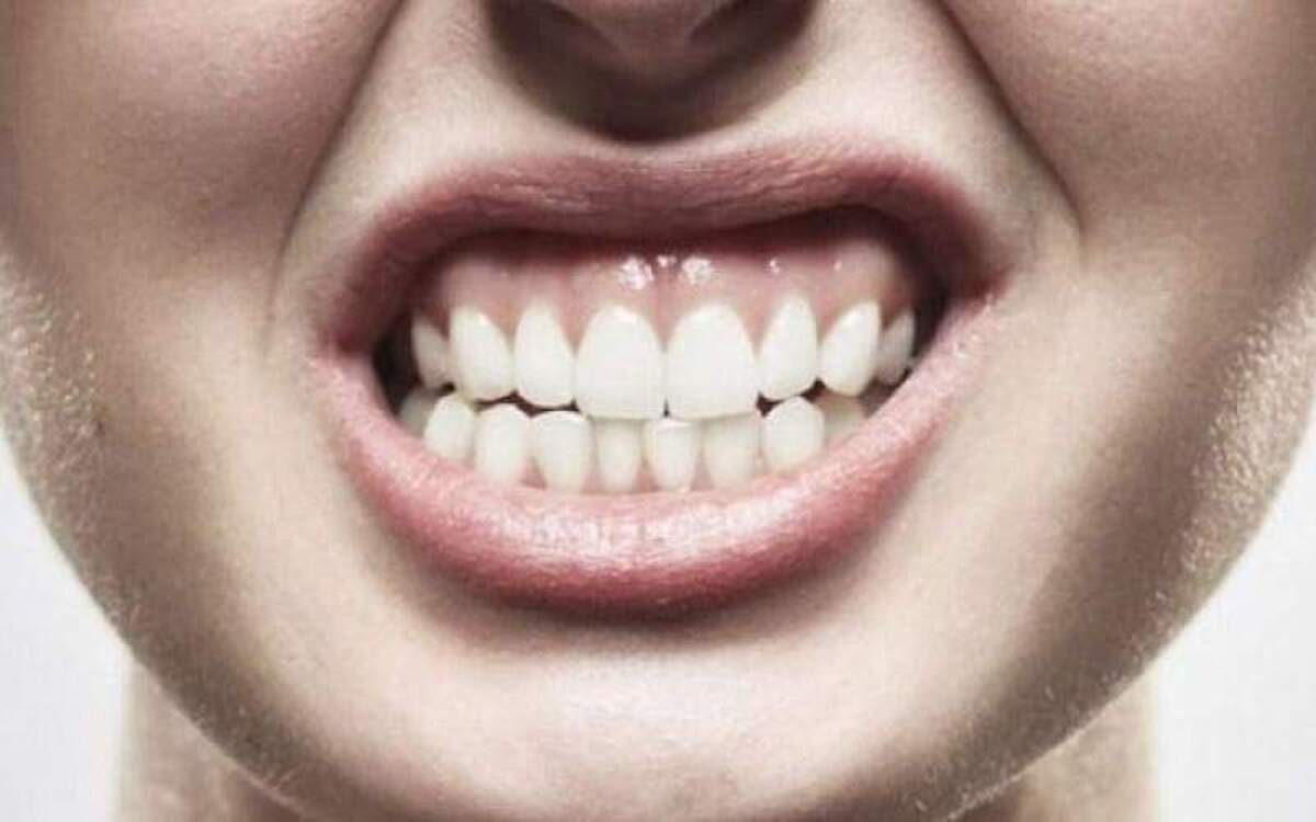 دندان‌قروچه چه علتی دارد؟