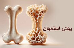 زنان یائسه در معرض خطر پوکی استخوان!