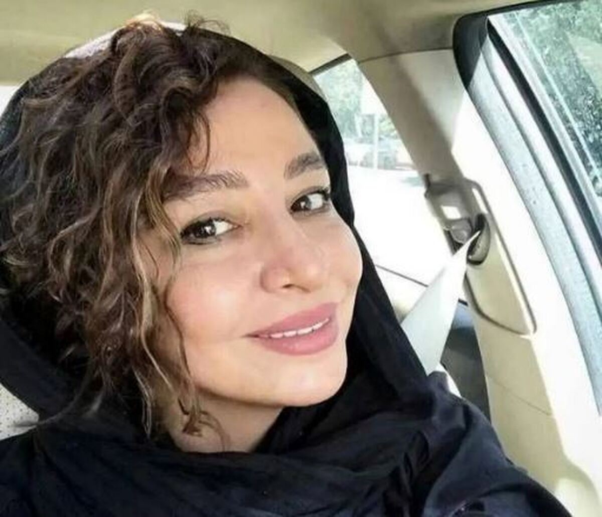 عمل‌های زیبایی مهلقا باقری چهره اش را دگرگون کرد! +عکس