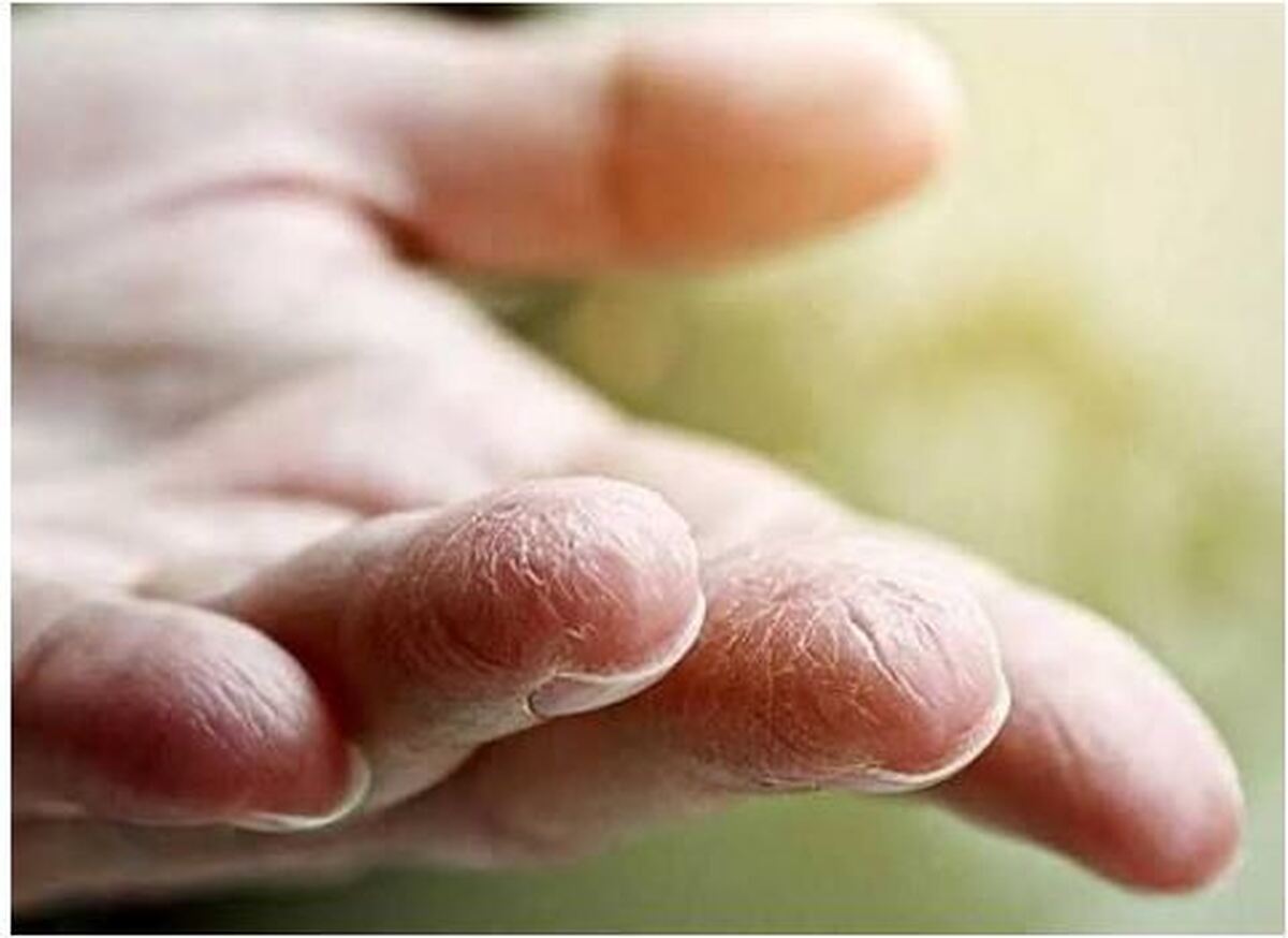 نکاتی برای بهداشت پوست در فصل پاییز