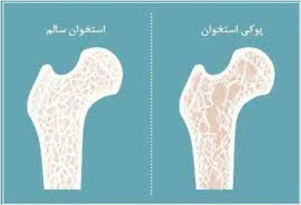 از جوانی مراقب بیماری‌های خاموش باشید