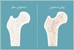از جوانی مراقب بیماری‌های خاموش باشید