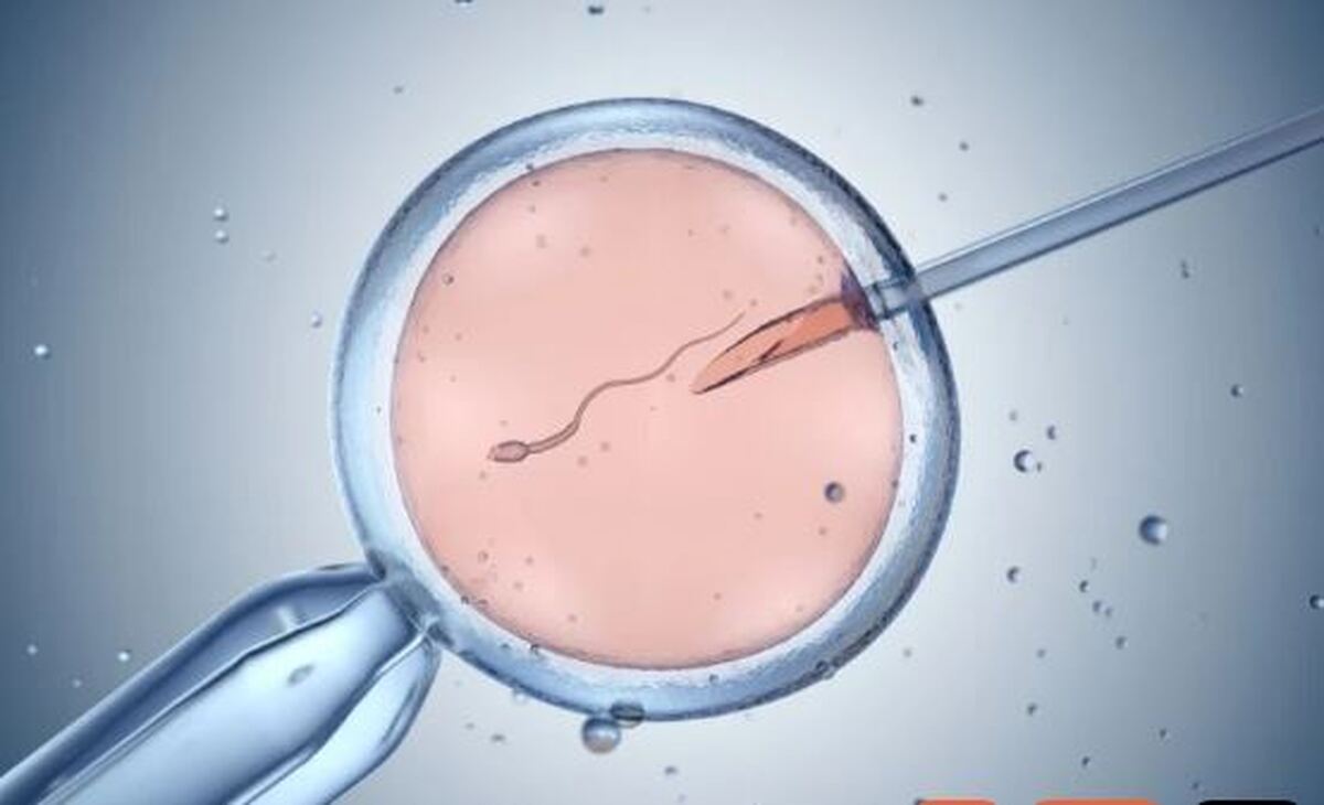 در روش لقاح مصنوعی چند درصد احتمال دختر دار شدن وجود دارد؟