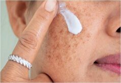 راهکار‌های ساده برای پاکسازی پوست و منافذ باز پوست
