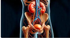 چند خوراکی که برای پاکسازی مثانه مفید است!