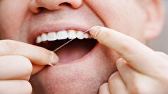 نخ دندان؛ سلاح ساده علیه سکته مغزی و قلبی