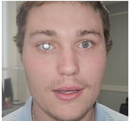 مردی که گرانترین چشم مصنوعی جهان را با یک الماس ۲ قیراطی ساخت مردی که گرانترین چشم مصنوعی جهان را با یک الماس ۲ قیراطی ساخت