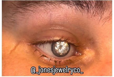 مردی که گرانترین چشم مصنوعی جهان را با یک الماس ۲ قیراطی ساخت مردی که گرانترین چشم مصنوعی جهان را با یک الماس ۲ قیراطی ساخت