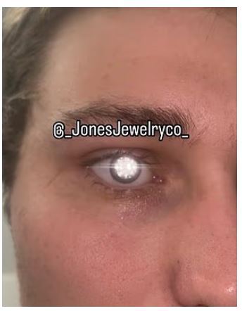 مردی که گرانترین چشم مصنوعی جهان را با یک الماس ۲ قیراطی ساخت مردی که گرانترین چشم مصنوعی جهان را با یک الماس ۲ قیراطی ساخت