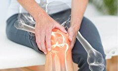 بهترین راه برای پیشگیری از ابتلا به پوکی استخوان