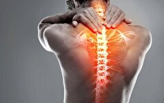 ساده‌ترین و کم هزینه‌ترین روش برای درمان کمردرد