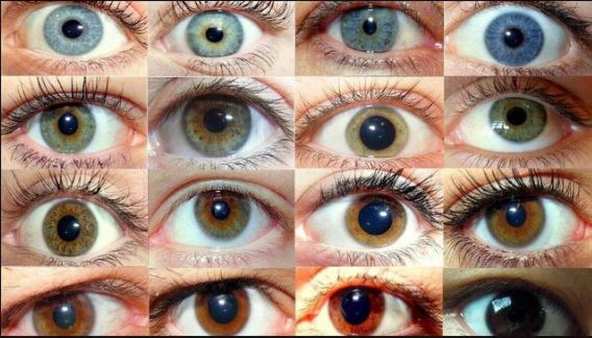 ترند جهانی تغییر رنگ چشم؛ از فیلتر‌های مجازی تا جراحی‌های پرخطر