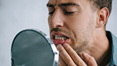 غذا‌هایی که خطر التهاب لثه را افزایش می‌دهند، شناسایی شده‌اند