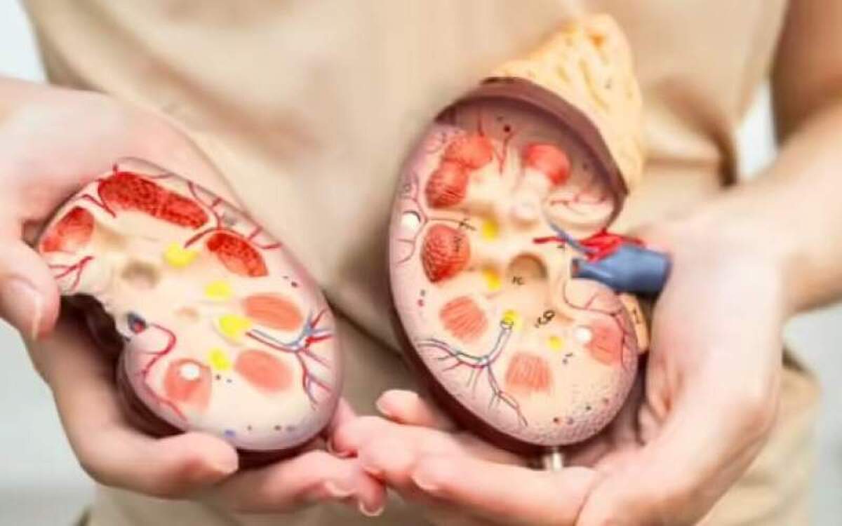 برای سلامت کلیهها از مصرف این خوراکیها غافل نشوید