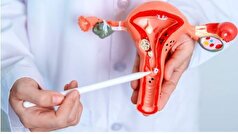 نفخ شکمی نشانه یک بیماری خطرناک در زنان!