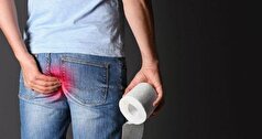 آشنایی با انواع، علت و علائم فیستول مقعدی