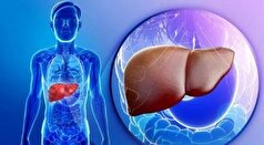 علائم سیروز کبدی و بیماری قلب دوم را جدی بگیرید