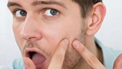 درمان جوش‌های مقاوم با بررسی علت بروز آن‌ها