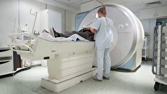 دکتر انواع سکته مغزی و خطرات آنها را فهرست کرد.