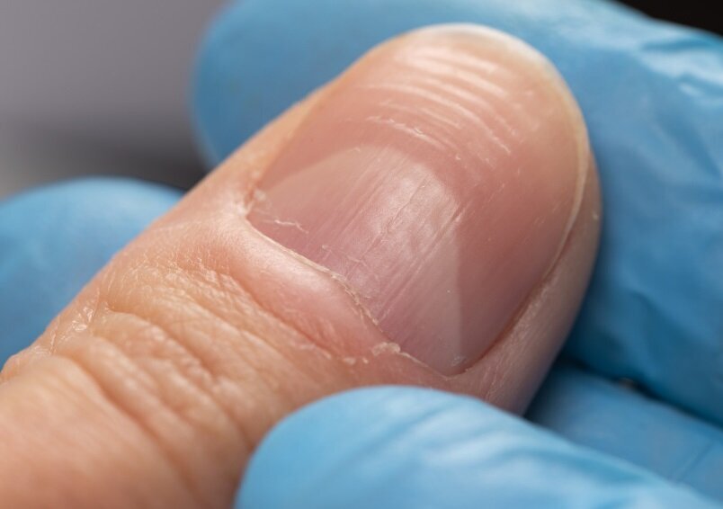 آیا میدانستید هلال ماه روی ناخن بیانگر خیلی از اسرار سلامتی بدن مان است؟ آیا میدانستید هلال ماه روی ناخن بیانگر خیلی از اسرار سلامتی بدن مان است؟