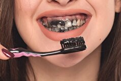 بررسی فواید و معایب خمیر دندان زغالی