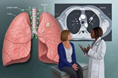 سرطان ریه| چگونه خطرات را به حداقل برسانیم