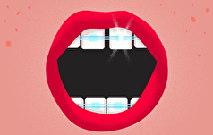 دلایل اینکه چرا پوسیدگی دندان دائماً ظاهر می‌شود، مشخص شد