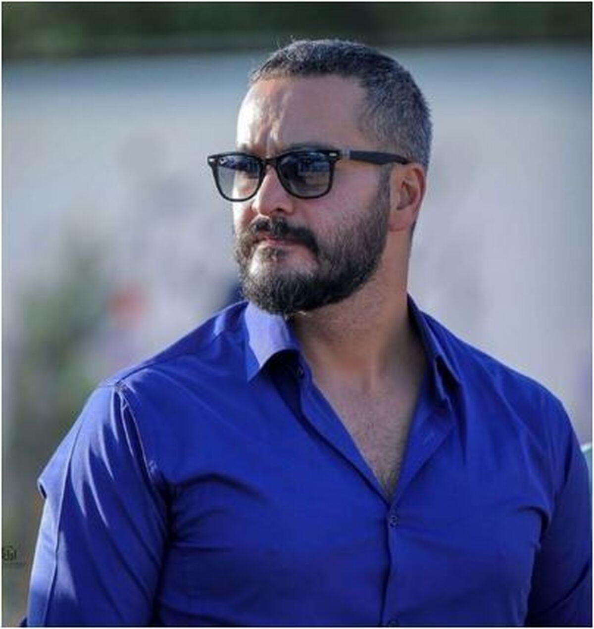 گریم میلاد کی مرام با مو‌های زرد برای فیلم روسی که زخمی شده+عکس