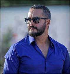 گریم میلاد کی مرام با مو‌های زرد برای فیلم روسی که زخمی شده+عکس