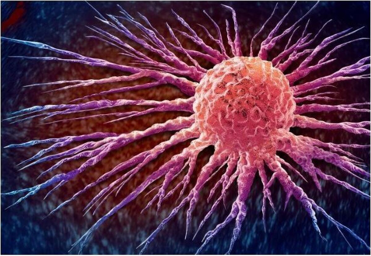 قدمی نو در درمان سرطان با کنترل عوارض جانبی شیمی درمانی