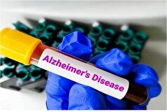 دارویی که می‌تواندبه کنترل آلزایمر کمک کند