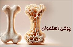چه کسانی نباید نمک مصرف کنند؟