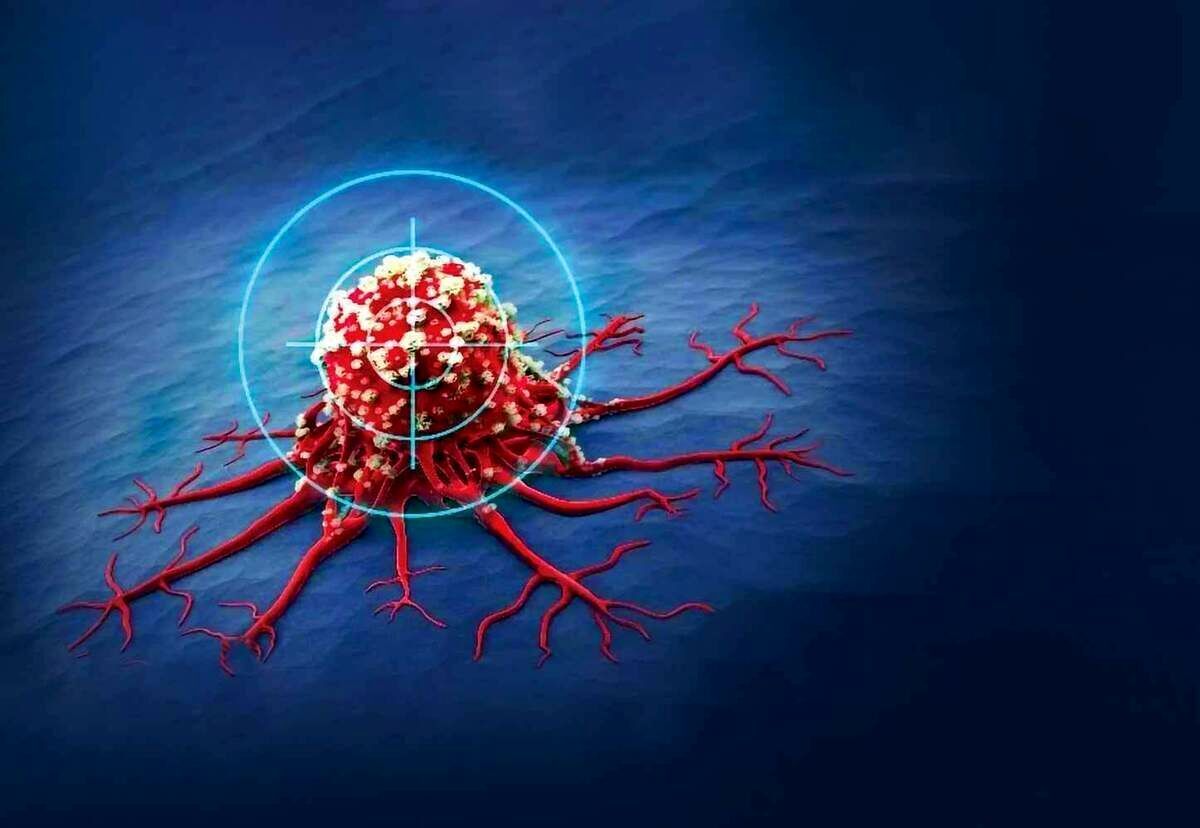 خون‌ریزی مقعدی شما را در معرض سرطان روده قرار میدهد!