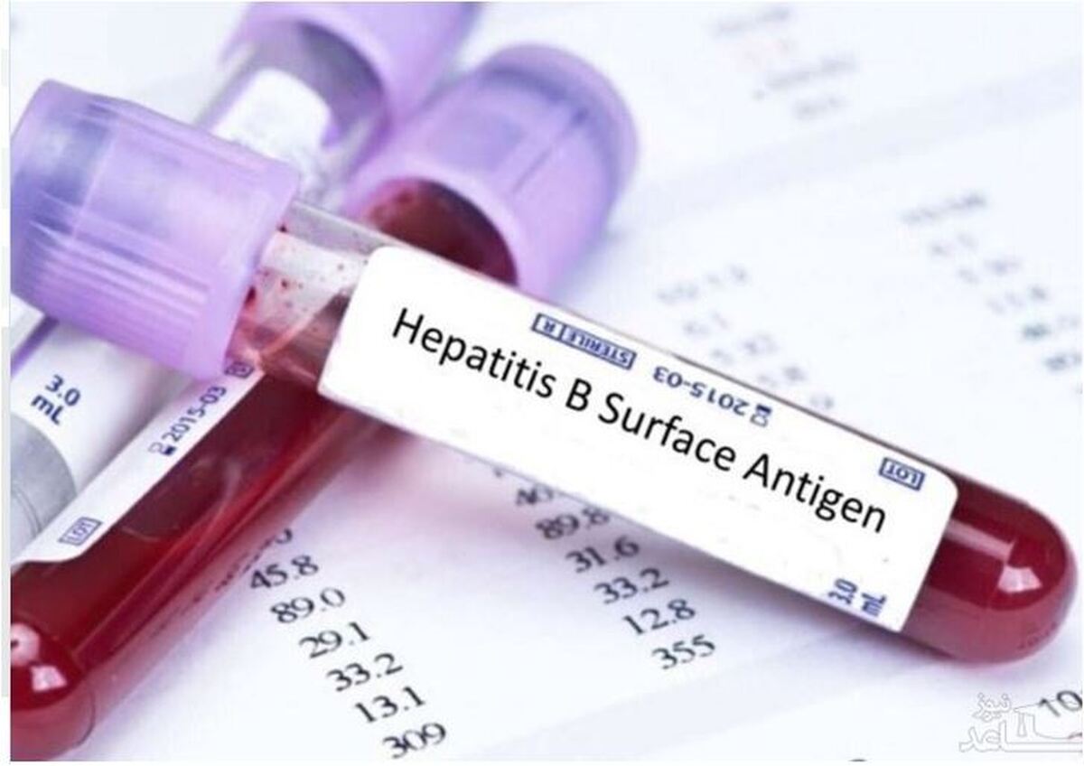 با آزمایش ساده خون از این بیماری خاموش مطلع شوید
