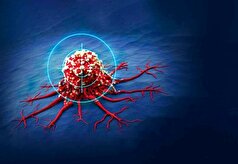 خون‌ریزی مقعدی شما را در معرض سرطان روده قرار میدهد!