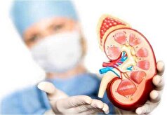 پیشرفت هوش مصنوعی در پیش‌بینی بقای بیماران پیوند کلیه