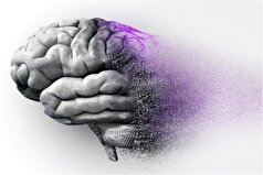 علائم  اولیه سکته مغزی را بشناسید واز آن ها غافل نشوید