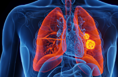 یک علامت سلامتی که می‌تواند نشانه‌ای از یک سرطان کشنده باشد!