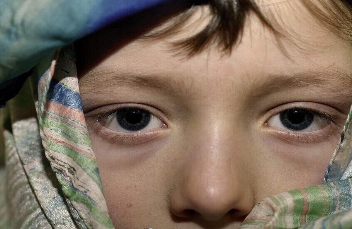 این فقط به دلیل بیدار ماندن تا دیروقت نیست... رنگ حلقه‌های تیره زیر چشم، بیماری‌های داخلی را آشکار می‌کنند