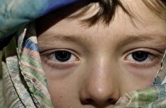 این فقط به دلیل بیدار ماندن تا دیروقت نیست... رنگ حلقه‌های تیره زیر چشم، بیماری‌های داخلی را آشکار می‌کنند