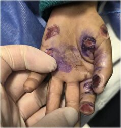 مرگ دلخراش پسربچه ۴ ساله به بدترین شکل ممکن، جنوب را عزادار کرد