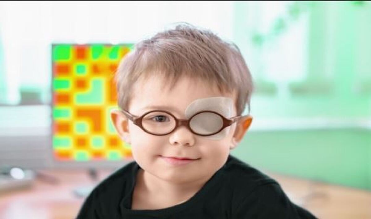 درمان بیش از ۱۳ هزار مورد تنبلی چشم در کودکان