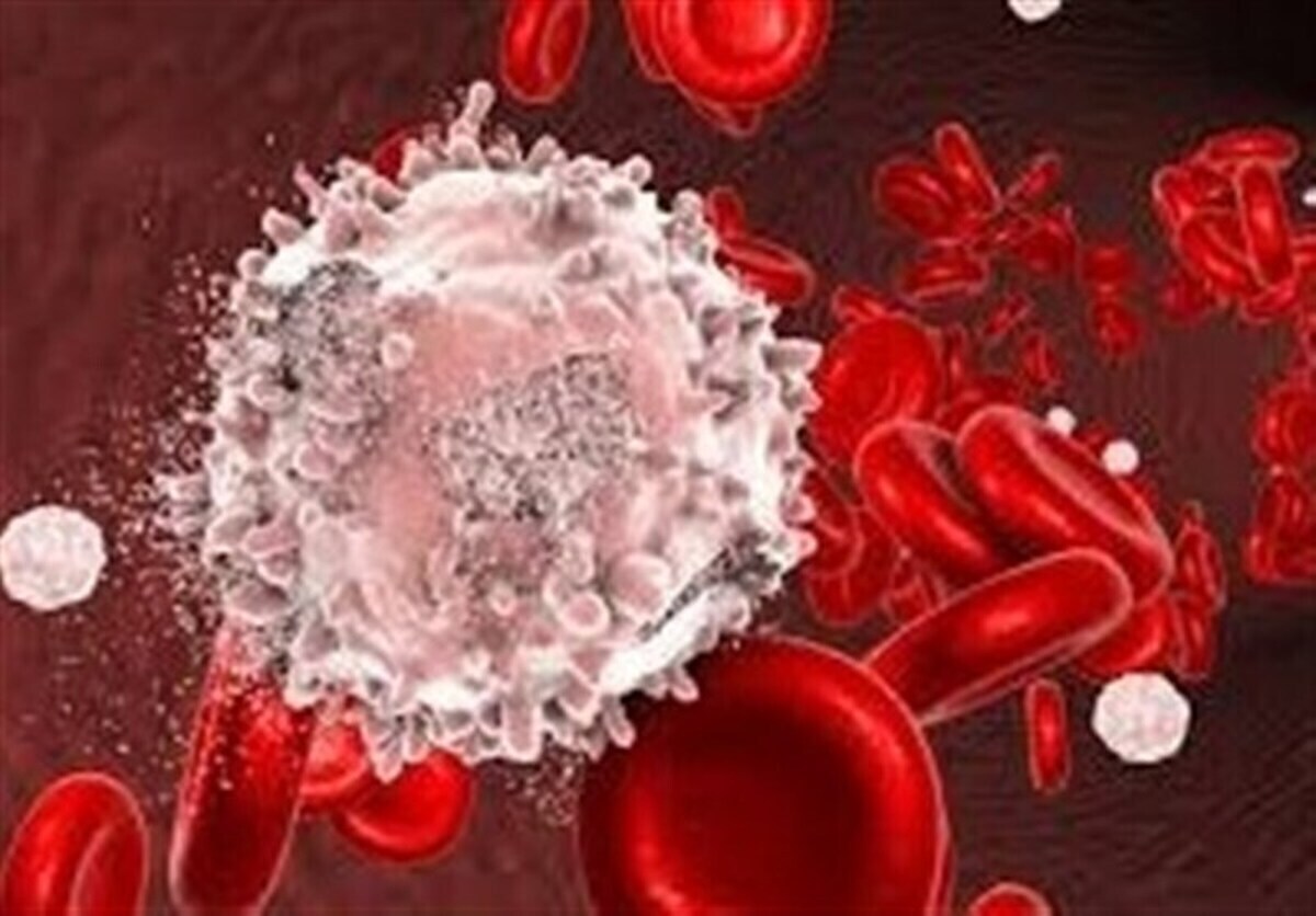 داروی جدیدی که که میتواند لوسمی میلوئید حاد را درمان کند!