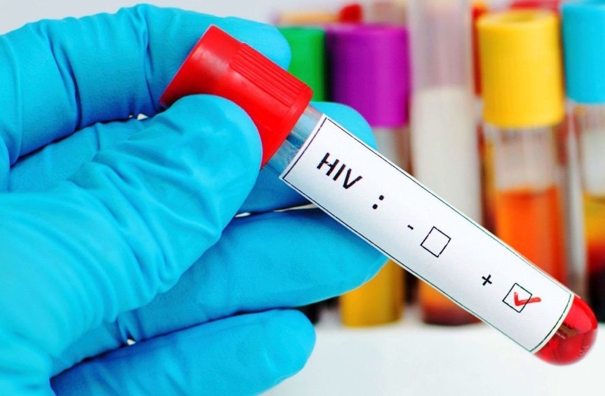 ویروس «فریبنده» HIV آنطور که قبلاً تصور می‌شد، غیرفعال نیست