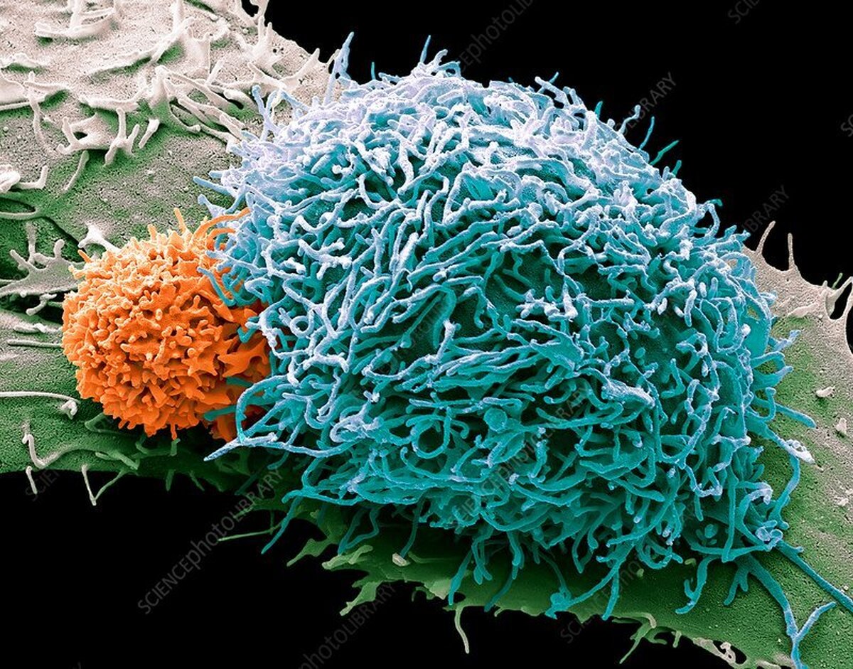 ایمونولوژی علمی: سلول‌های ایمنی برای متوقف کردن سرطان روده بزرگ بسیار مهم هستند