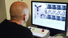 دانشمندان در مورد تأثیر اعصاب آسیب‌دیده بر ایمنی بدن بحث کرده‌اند.